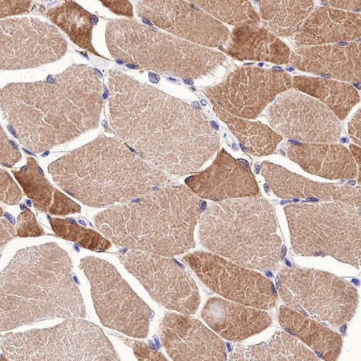 NDRG2 Recombinant Rabbit mAb (S-618-76)