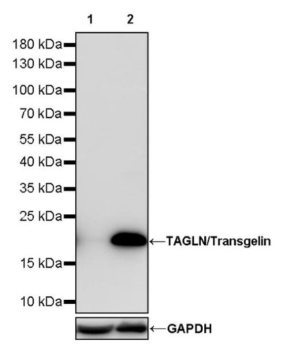 TAGLN/Transgelin Recombinant Rabbit mAb (S-1715-59)