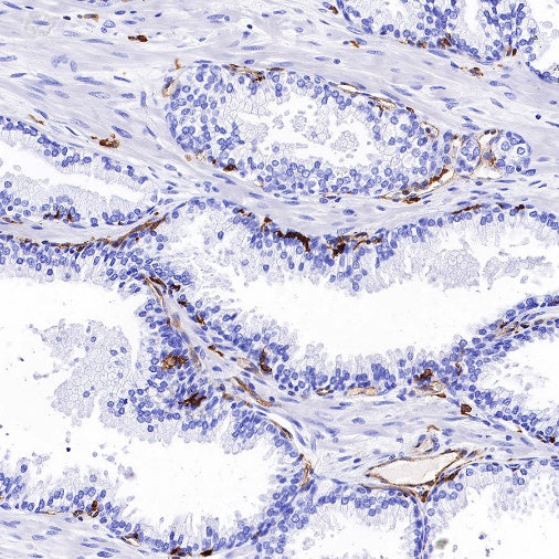 HLA-DP alpha1 Recombinant Rabbit mAb (S-R243)
