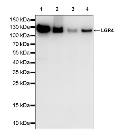 LGR4 Recombinant Rabbit mAb (S-2787-39)