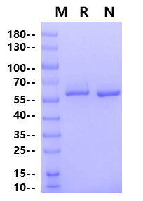 ALK5 GST Tag Protein, Human