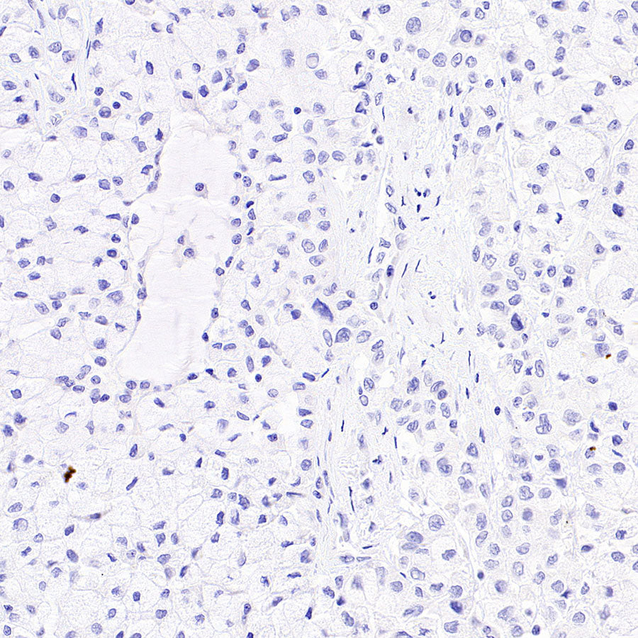 Desmoglein 3 Recombinant Rabbit mAb (SDT-3213-33)