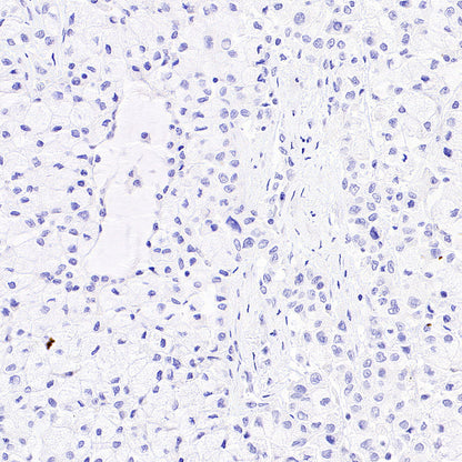 Desmoglein 3 Recombinant Rabbit mAb (SDT-3213-33)