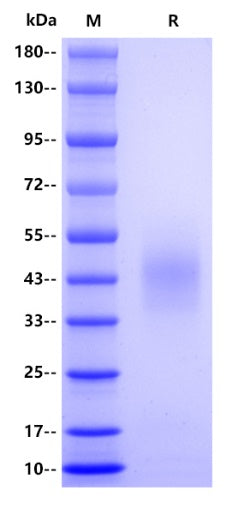 Human CD300A Protein, His tag