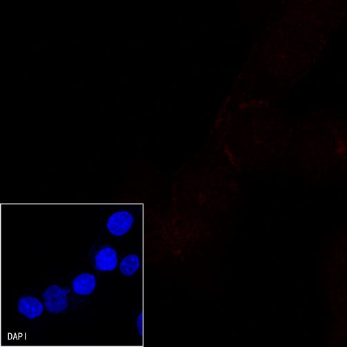 E-Cadherin Recombinant Rabbit mAb (Alexa Fluor® 555 Conjugate) (S-438-5)
