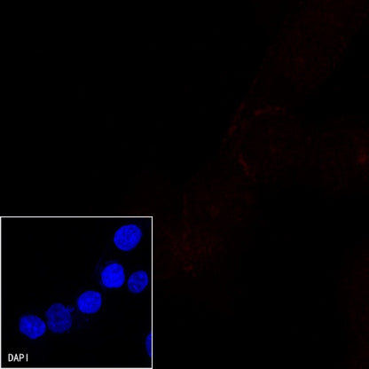 E-Cadherin Recombinant Rabbit mAb (Alexa Fluor® 555 Conjugate) (S-438-5)