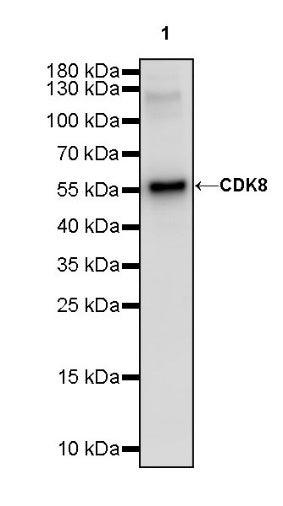 CDK8 Recombinant Rabbit mAb (S-1627-70)