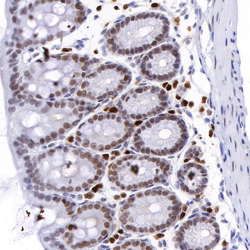 S-RMab®Topoisomerase I Recombinant Rabbit mAb (S-R209)