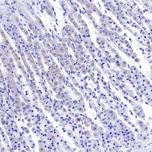 SDHA Recombinant Rabbit mAb (S-1458-43)
