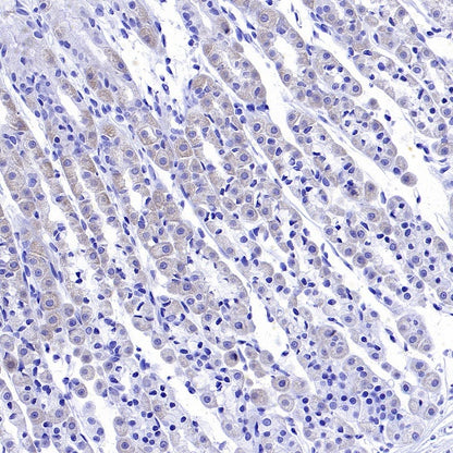 SDHA Recombinant Rabbit mAb (S-1458-43)