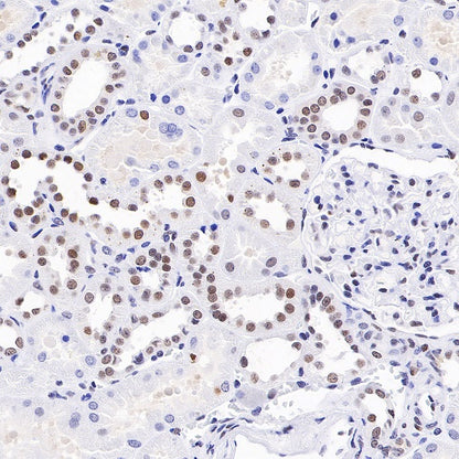 E2F4 Recombinant Rabbit mAb (S-586-214)