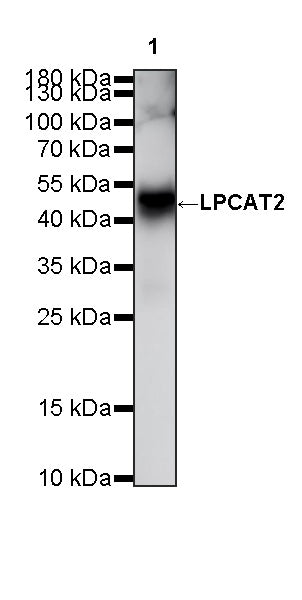 LPCAT2 Recombinant Rabbit mAb (S-4239-18)