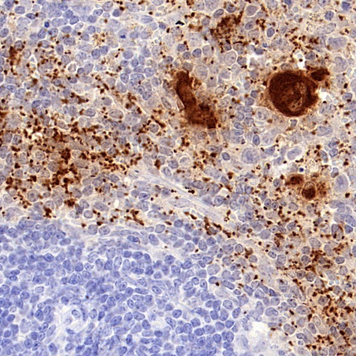 PF4 Recombinant Rabbit mAb (S-4220)