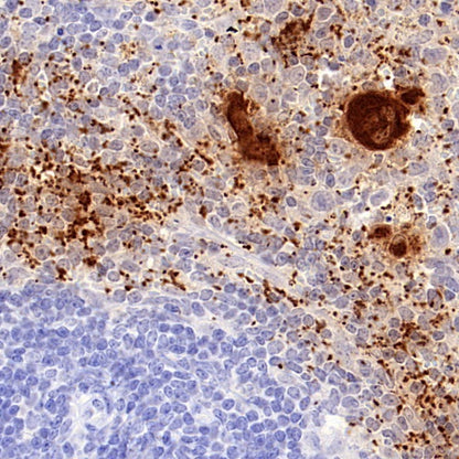 PF4 Recombinant Rabbit mAb (S-4220)