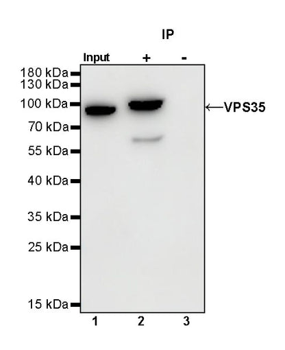 VPS35 Recombinant Rabbit mAb (S-997-2)