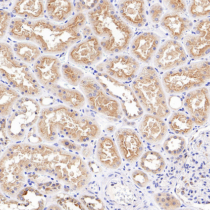 NTSR1 Recombinant Rabbit mAb (S-4844-38)