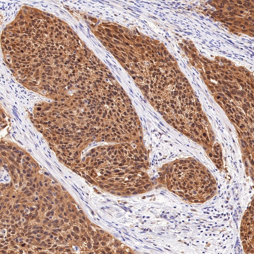 S100A11 Recombinant Rabbit mAb (S-821-4)