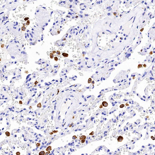 Cathepsin B Recombinant Rabbit mAb (S-1067-7)