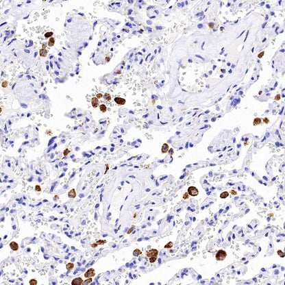 Cathepsin B Recombinant Rabbit mAb (S-1067-7)