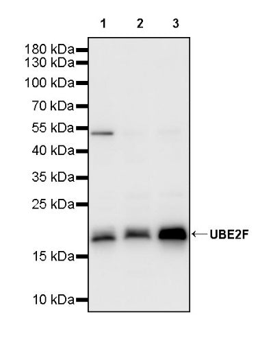 UBE2F Recombinant Rabbit mAb (S-2672-26)