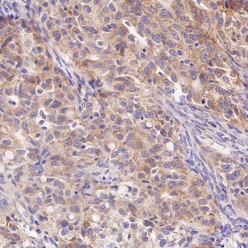 UBE2F Recombinant Rabbit mAb (S-2672-26)