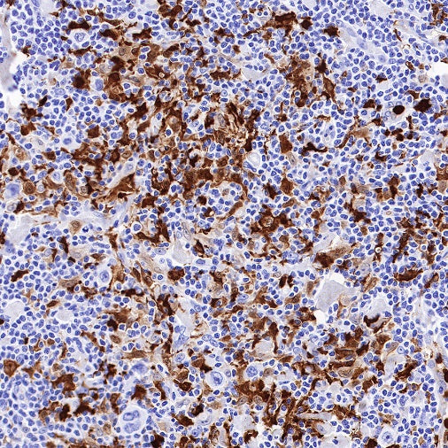 S100A8/MRP8 Recombinant Rabbit mAb (S-R251)
