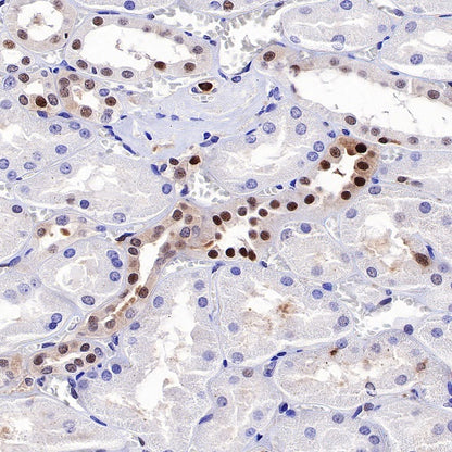 SQSTM1/p62 Recombinant Rabbit mAb (S-R346)