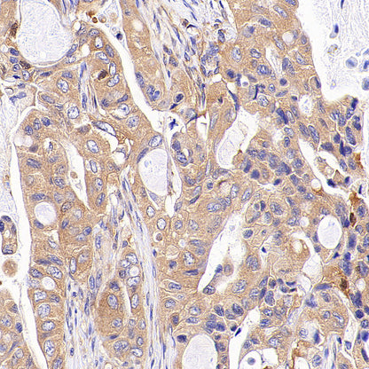 AP-2α Recombinant Rabbit mAb (S-4444-44)