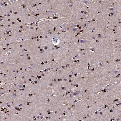 TKT Rabbit Polyclonal Antibody