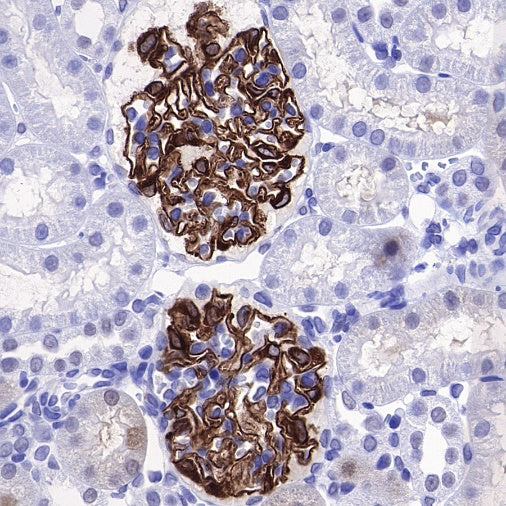 Nephrin Recombinant Rabbit mAb (S-543-63)