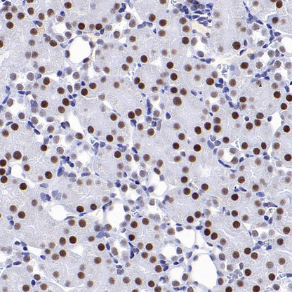 CDK9 Rabbit Polyclonal Antibody