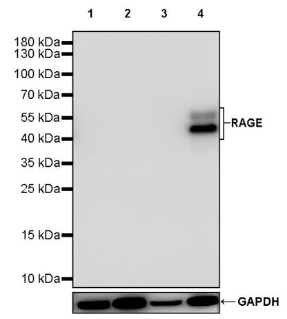 RAGE Recombinant Rabbit mAb (S-1846-41)