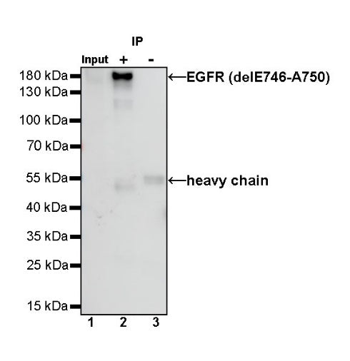 EGFR (delE746-A750) Recombinant Rabbit mAb (S-451-168)