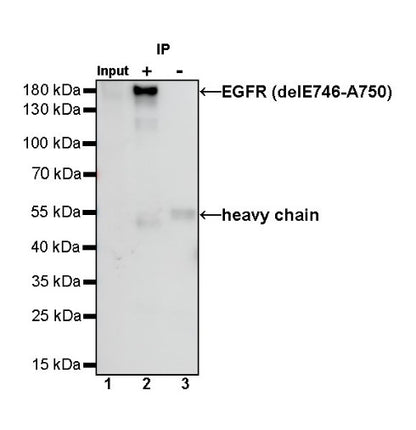 EGFR (delE746-A750) Recombinant Rabbit mAb (S-451-168)
