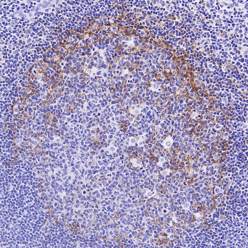 LRRC15 Recombinant Rabbit mAb (S-2473-43)
