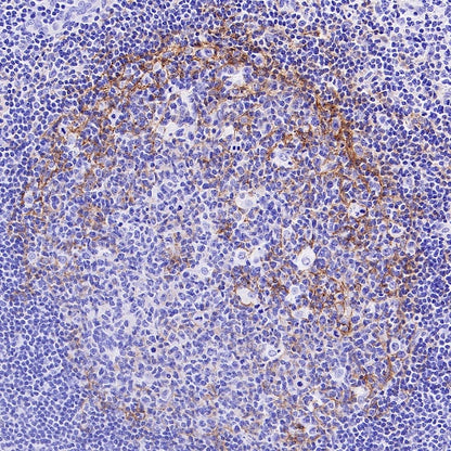 LRRC15 Recombinant Rabbit mAb (S-2473-43)