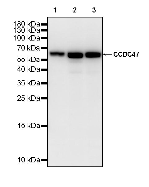 CCDC47 Recombinant Rabbit mAb (S-4158-17)