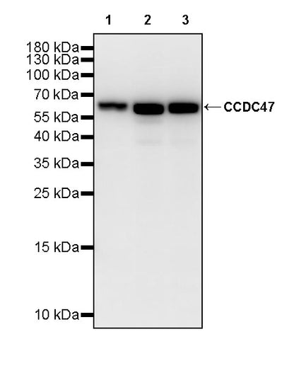 CCDC47 Recombinant Rabbit mAb (S-4158-17)