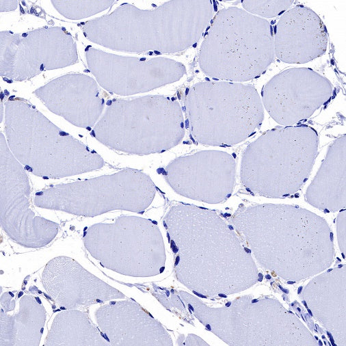 SH-PTP2 Recombinant Rabbit mAb (S-1318-2)