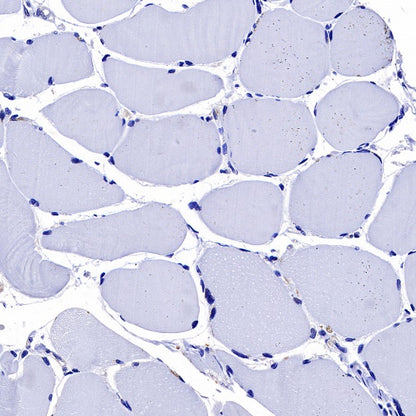 SH-PTP2 Recombinant Rabbit mAb (S-1318-2)
