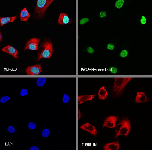 PAX8 Recombinant Rabbit mAb (SDT-R509)
