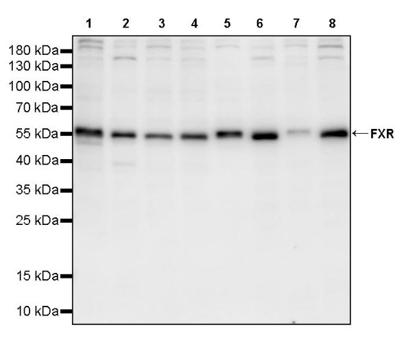 FXR Recombinant Rabbit mAb (S-2845-71)