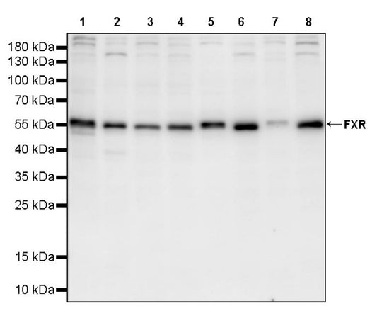 FXR Recombinant Rabbit mAb (S-2845-71)