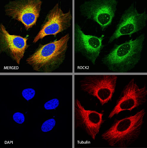 ROCK2 Rabbit Polyclonal Antibody
