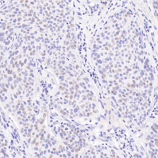 Histone H3 (acetyl K4) Recombinant Rabbit mAb (S-848-137)