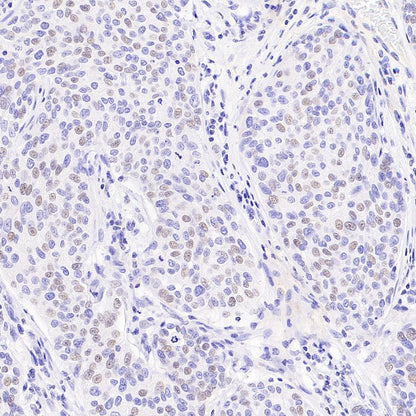 Histone H3 (acetyl K4) Recombinant Rabbit mAb (S-848-137)