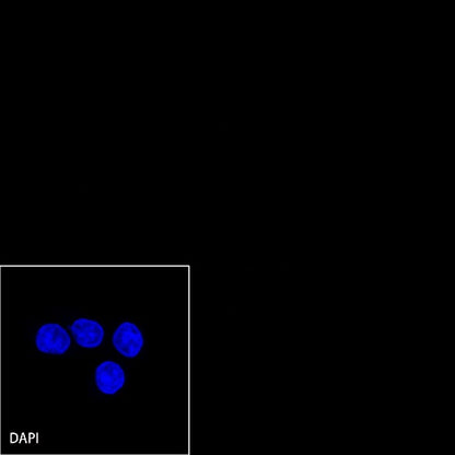 MLH1 Recombinant Rabbit mAb (SDT-112-50)
