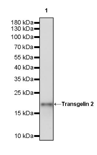 Transgelin 2 Recombinant Rabbit mAb (S-2809-73)