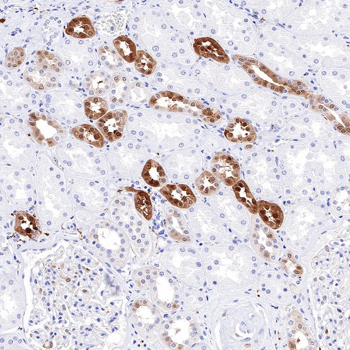 PGP9.5 Recombinant Rabbit mAb (SDT-665-37)