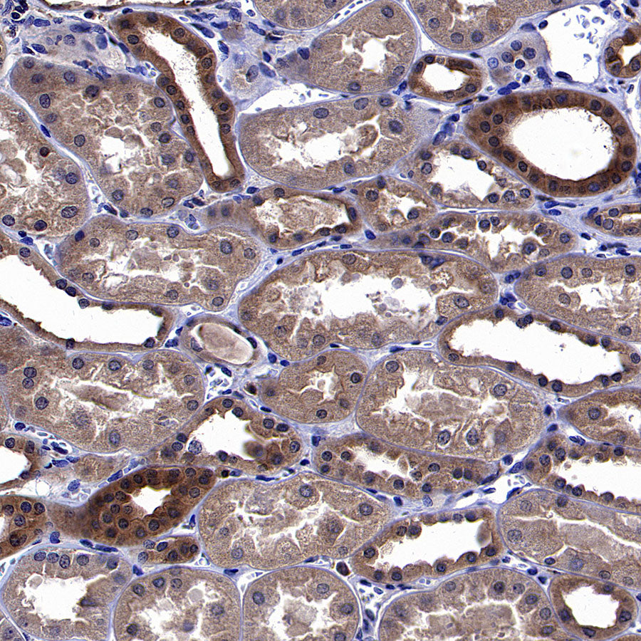 ARF6 Recombinant Rabbit mAb (S-4283-62)
